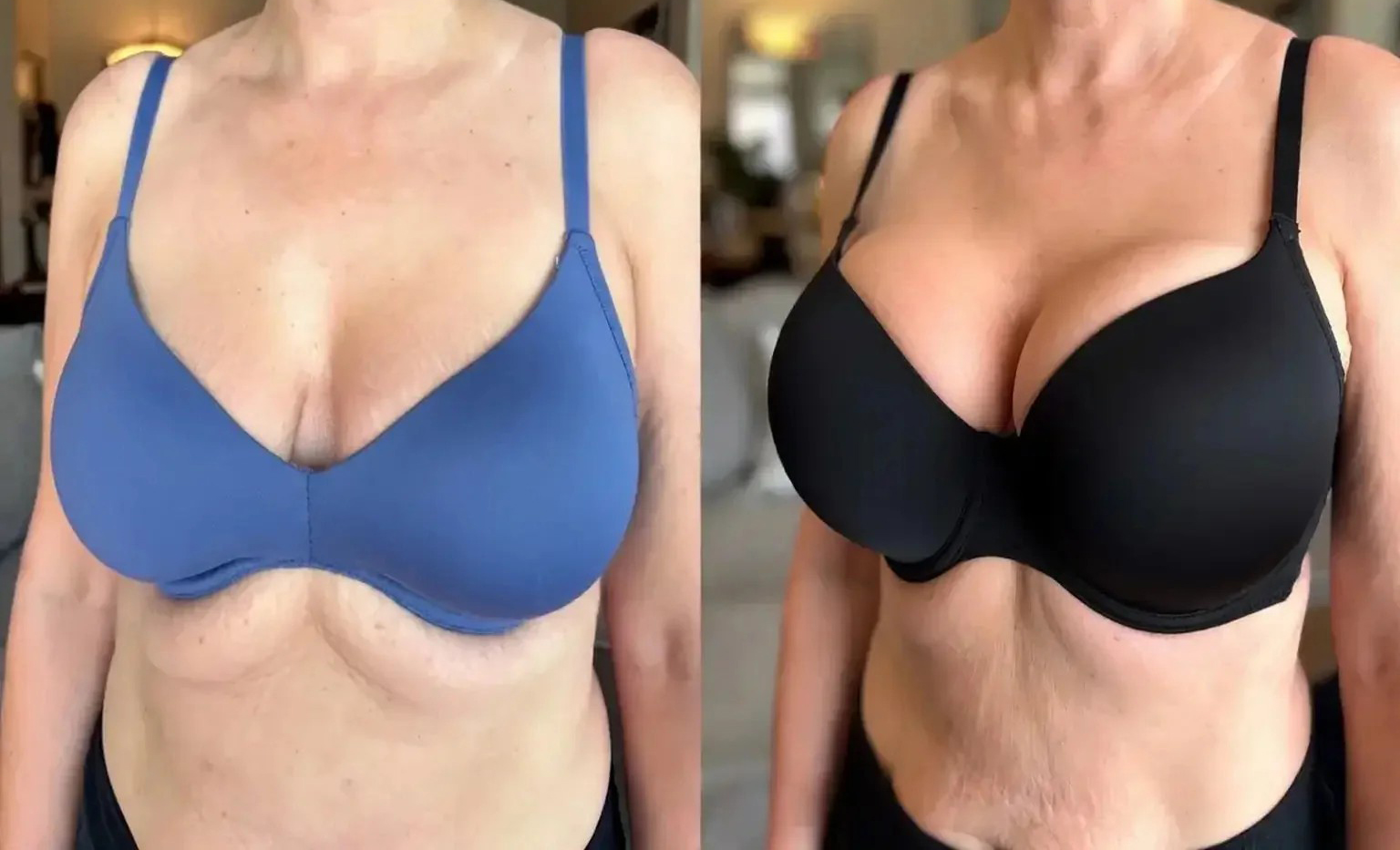 나노 영양 공급 가슴 확대 패치로 더욱 풍만하고 매력적인 가슴을 만들어보세요. 한 상자에 10개의 패치가 들어있습니다. photo review