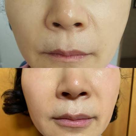 핑크 콜라겐 안티에이징 리페어 세럼 – 이중 작용 포뮬러: 피부 장벽 복구, 피부톤 개선 + 5% 나이아신아마이드 함유, 57ml photo review