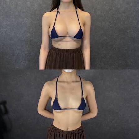 나노 영양 공급 가슴 확대 패치로 더욱 풍만하고 매력적인 가슴을 만들어보세요. 한 상자에 10개의 패치가 들어있습니다. photo review