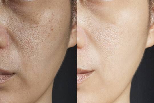 펩타이드 콜라겐, 펩타이드 콜라겐 엘라스틱 에센스 크림, 미세 분자 퍼밍 및 리프팅 로션, 탄력 있는 피부에 적합 (2개입/상자) (2개) photo review