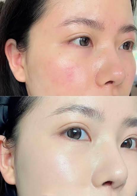 펩타이드 콜라겐, 펩타이드 콜라겐 엘라스틱 에센스 크림, 미세 분자 퍼밍 및 리프팅 로션, 탄력 있는 피부에 적합 (2개입/상자) (2개) photo review
